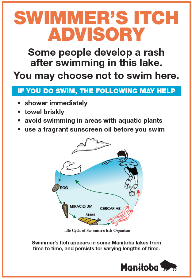 Swimmers_Itch